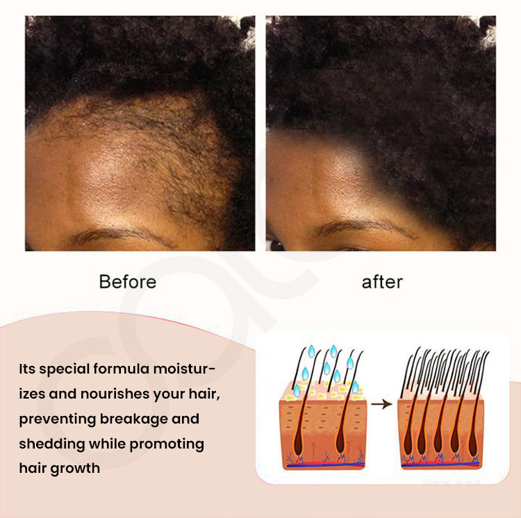 Chebe Butter Scalp Care